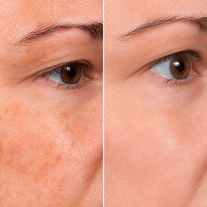 Hialura® - Serum Antiedad